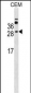 MS4A3 Antibody (Center)
